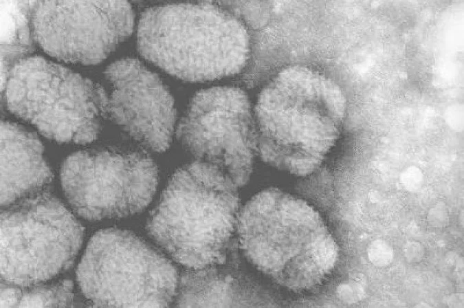 Brasil ultrapassa 4 mil casos registrados de varíola dos macacos