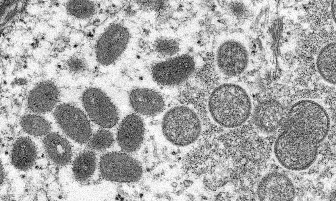 dia de casos de varíola dos macacos sobe exceto 173 no Brasil –