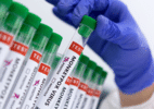saturado de Janeiro tem 28 casos de varíola confirmados