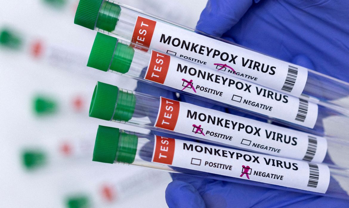 Brasil chega a 5 mortes por varíola dos macacos pilha novos óbitos