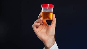 O que significa espuma na urina? Substâncias expelidas no xixi podem indicar problemas de saúde – Notícias