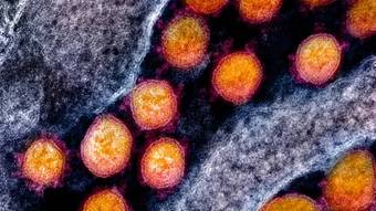 Composto testado na USP reduz inflamação da Covid-19 sem comprometer a resposta imune ao vírus – Notícias