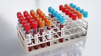 Exame de sangue em fase de testes é capaz de identificar 50 tipos de câncer, sugere estudo – Notícias
